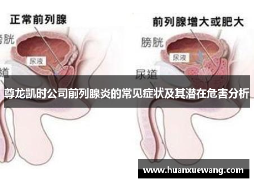 尊龙凯时公司前列腺炎的常见症状及其潜在危害分析